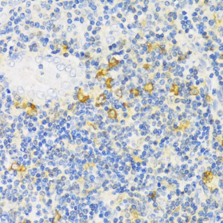 Immunohistochemistry - Anti-MLKL Antibody (A91618) - Antibodies.com