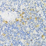 Immunohistochemistry - Anti-MLKL Antibody (A91618) - Antibodies.com