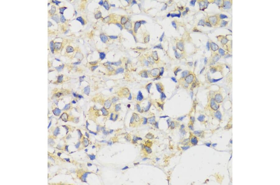 Immunohistochemistry - Anti-MLKL Antibody (A91618) - Antibodies.com