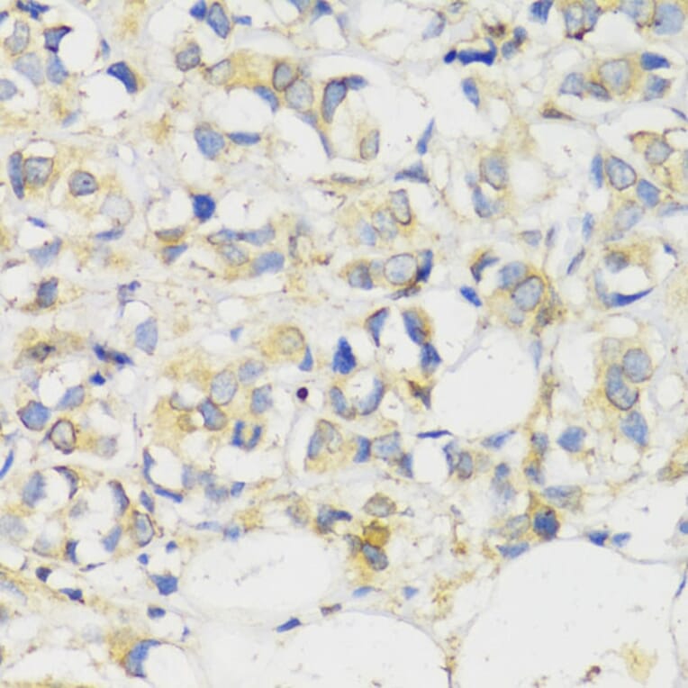 Immunohistochemistry - Anti-MLKL Antibody (A91618) - Antibodies.com