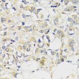Immunohistochemistry - Anti-MLKL Antibody (A91618) - Antibodies.com