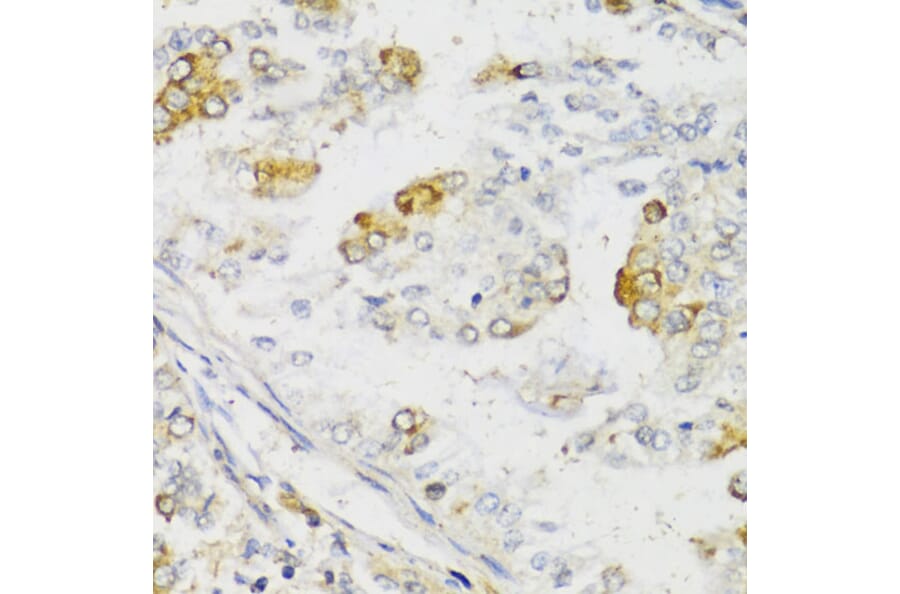 Immunohistochemistry - Anti-MLKL Antibody (A91618) - Antibodies.com