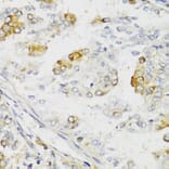 Immunohistochemistry - Anti-MLKL Antibody (A91618) - Antibodies.com
