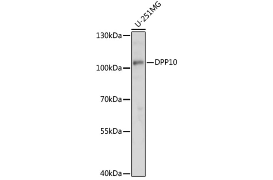 Western Blot - Anti-DPP10 Antibody (A91620) - Antibodies.com