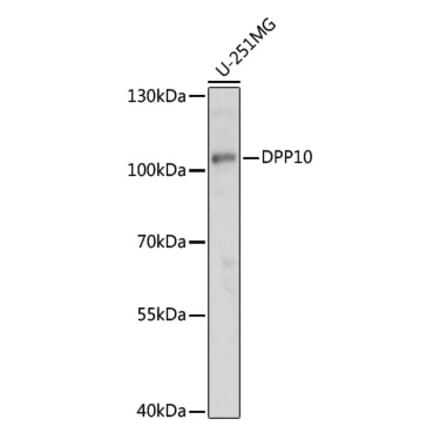 Western Blot - Anti-DPP10 Antibody (A91620) - Antibodies.com