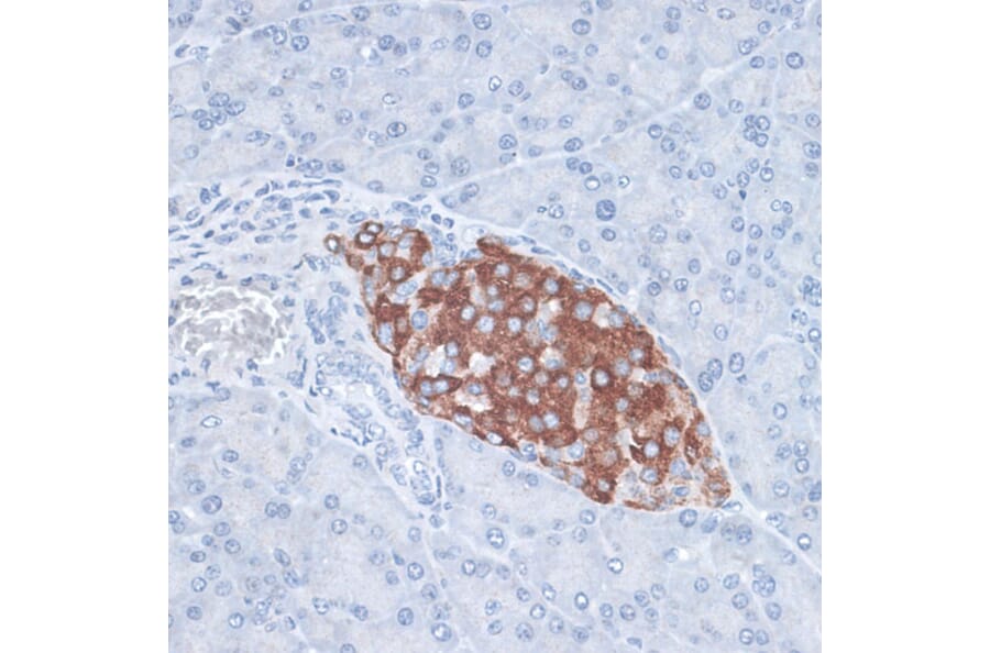 Immunohistochemistry - Anti-HDAC7 Antibody (A91621) - Antibodies.com
