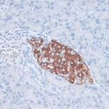 Immunohistochemistry - Anti-HDAC7 Antibody (A91621) - Antibodies.com