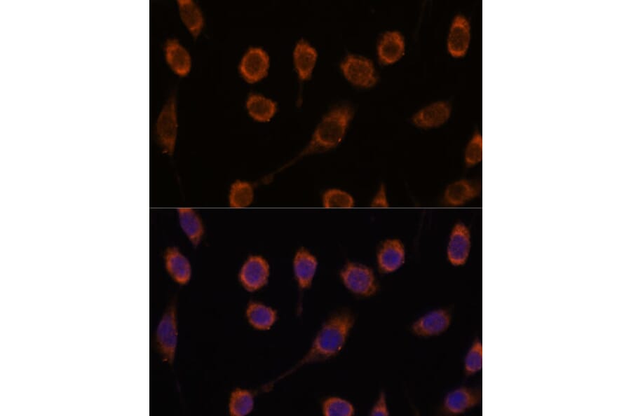 Immunofluorescence - Anti-GLUT9 Antibody (A91622) - Antibodies.com