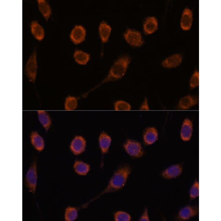 Immunofluorescence - Anti-GLUT9 Antibody (A91622) - Antibodies.com