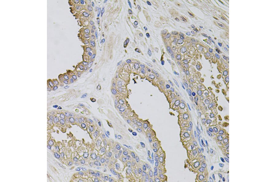 Immunohistochemistry - Anti-TRPV3 Antibody (A12613) - Antibodies.com