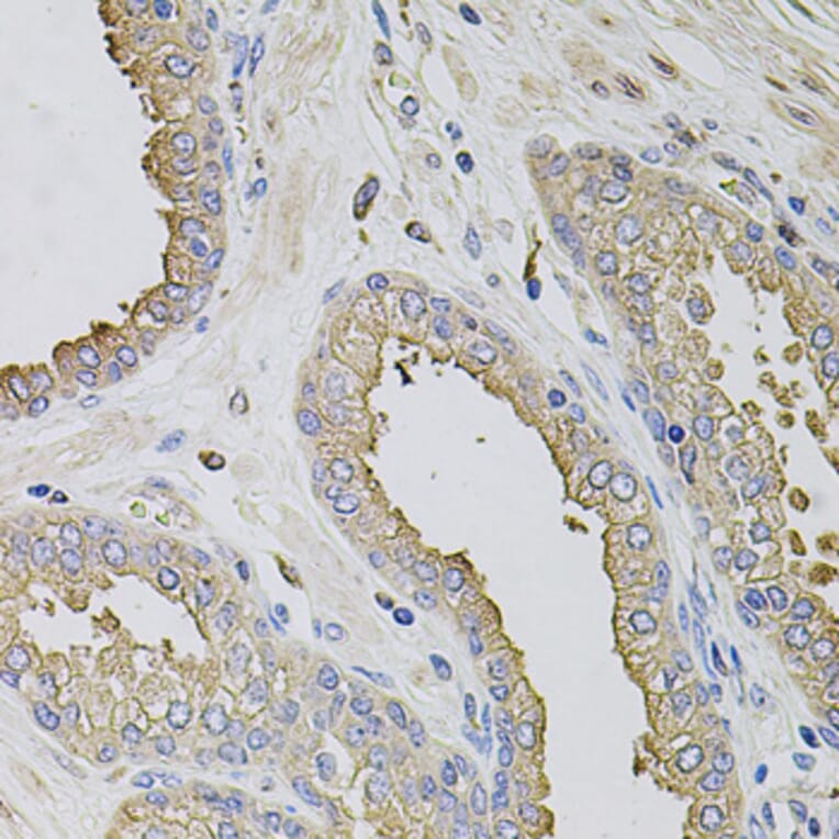 Immunohistochemistry - Anti-TRPV3 Antibody (A12613) - Antibodies.com