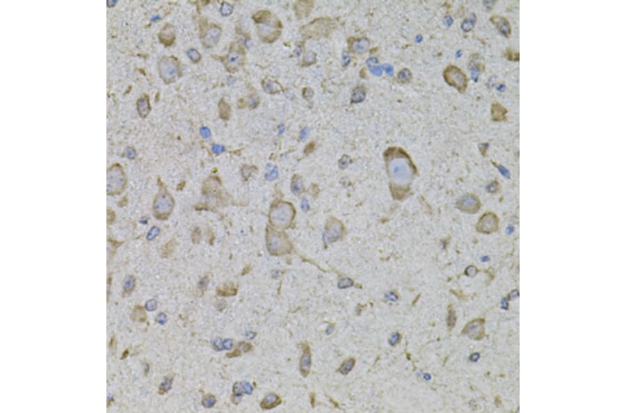 Immunohistochemistry - Anti-TRPV3 Antibody (A12613) - Antibodies.com