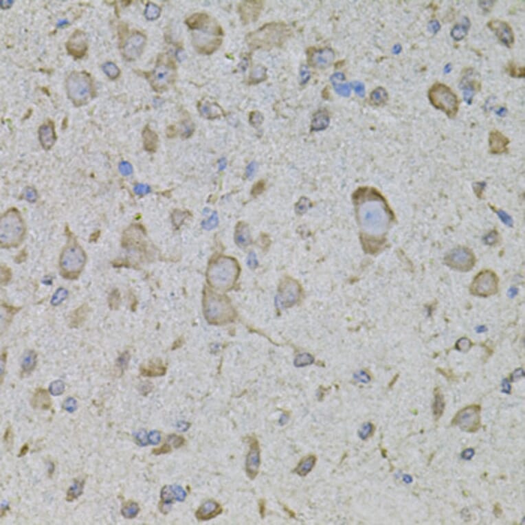 Immunohistochemistry - Anti-TRPV3 Antibody (A12613) - Antibodies.com