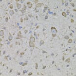 Immunohistochemistry - Anti-TRPV3 Antibody (A12613) - Antibodies.com