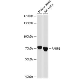 Western Blot - Anti-PARP2 Antibody (A91627) - Antibodies.com