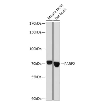 Western Blot - Anti-PARP2 Antibody (A91627) - Antibodies.com