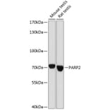 Western Blot - Anti-PARP2 Antibody (A91627) - Antibodies.com