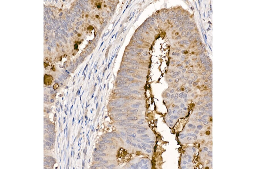 Immunohistochemistry - Anti-MUC2 Antibody (A91628) - Antibodies.com