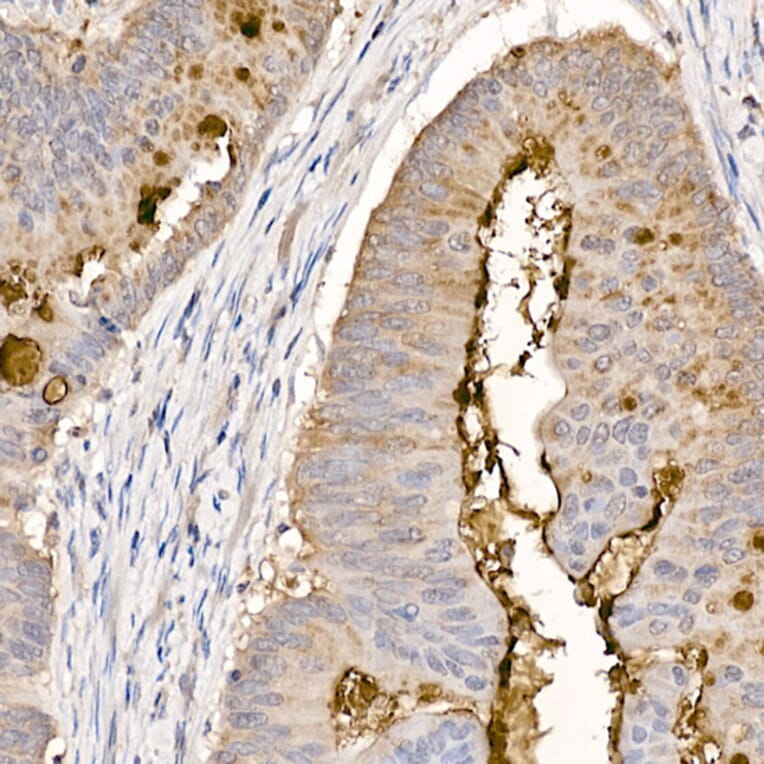 Immunohistochemistry - Anti-MUC2 Antibody (A91628) - Antibodies.com