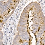 Immunohistochemistry - Anti-MUC2 Antibody (A91628) - Antibodies.com