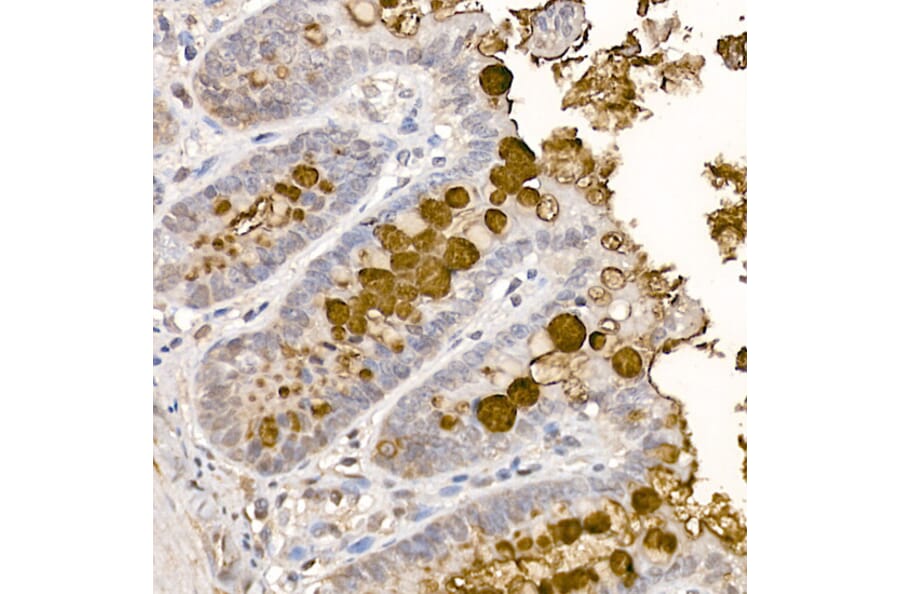 Immunohistochemistry - Anti-MUC2 Antibody (A91628) - Antibodies.com