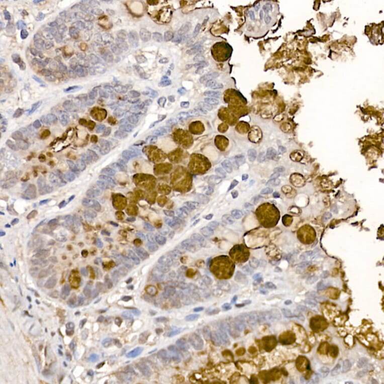 Immunohistochemistry - Anti-MUC2 Antibody (A91628) - Antibodies.com