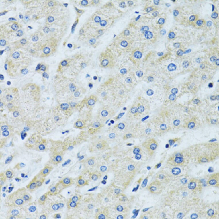 Immunohistochemistry - Anti-SLC5A6 Antibody (A14814) - Antibodies.com