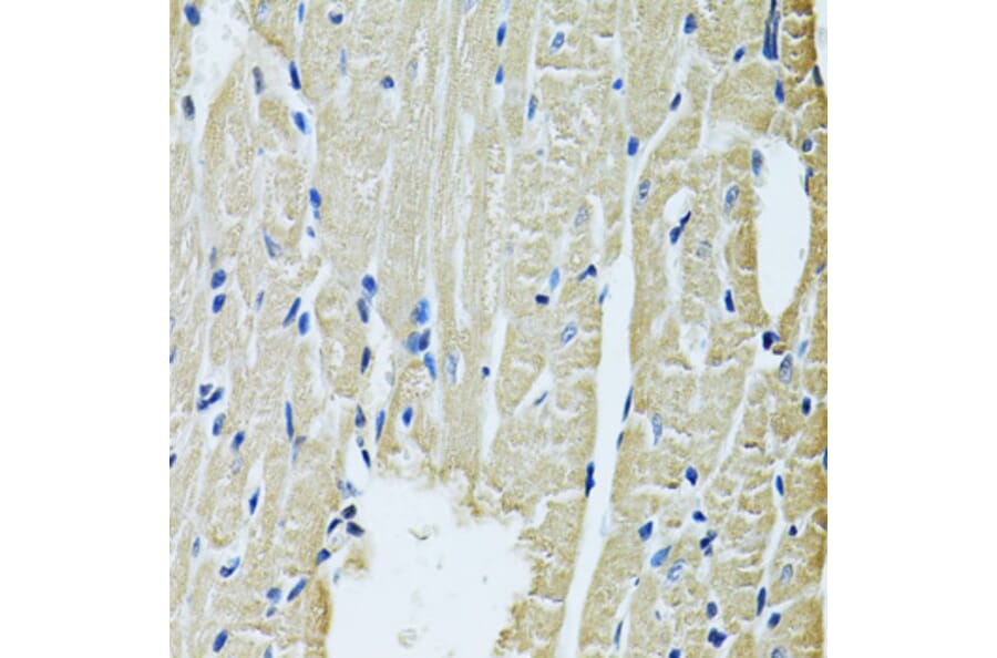 Immunohistochemistry - Anti-SLC5A6 Antibody (A14814) - Antibodies.com