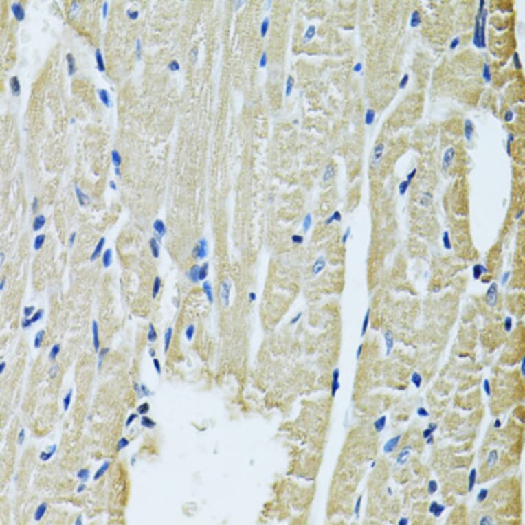 Immunohistochemistry - Anti-SLC5A6 Antibody (A14814) - Antibodies.com