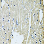 Immunohistochemistry - Anti-SLC5A6 Antibody (A14814) - Antibodies.com