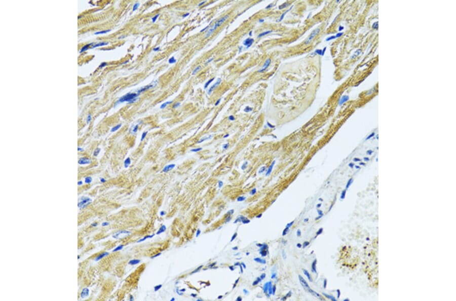 Immunohistochemistry - Anti-SLC5A6 Antibody (A14814) - Antibodies.com