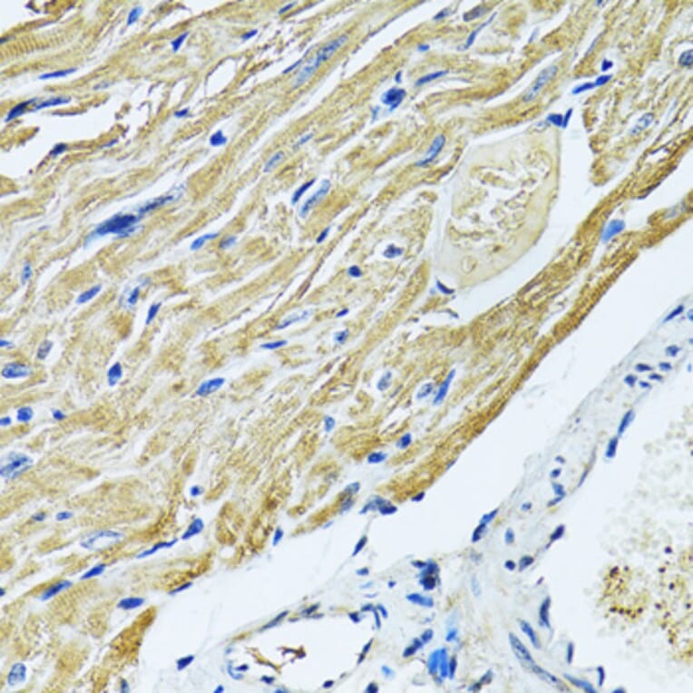 Immunohistochemistry - Anti-SLC5A6 Antibody (A14814) - Antibodies.com