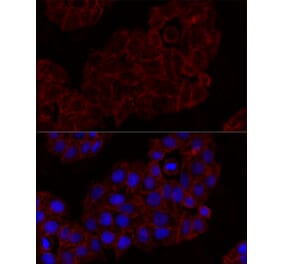 Immunofluorescence - Anti-NKG2D Antibody (A91639) - Antibodies.com