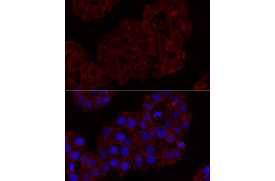 Immunofluorescence - Anti-NKG2D Antibody (A91639) - Antibodies.com