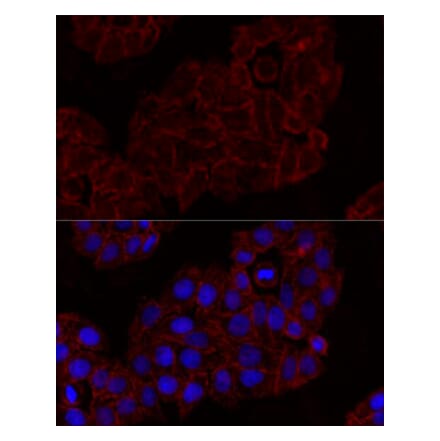 Immunofluorescence - Anti-NKG2D Antibody (A91639) - Antibodies.com