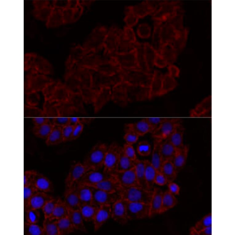 Immunofluorescence - Anti-NKG2D Antibody (A91639) - Antibodies.com