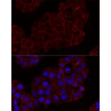 Immunofluorescence - Anti-NKG2D Antibody (A91639) - Antibodies.com