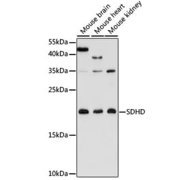 Western Blot - Anti-SDHD Antibody (A91641) - Antibodies.com