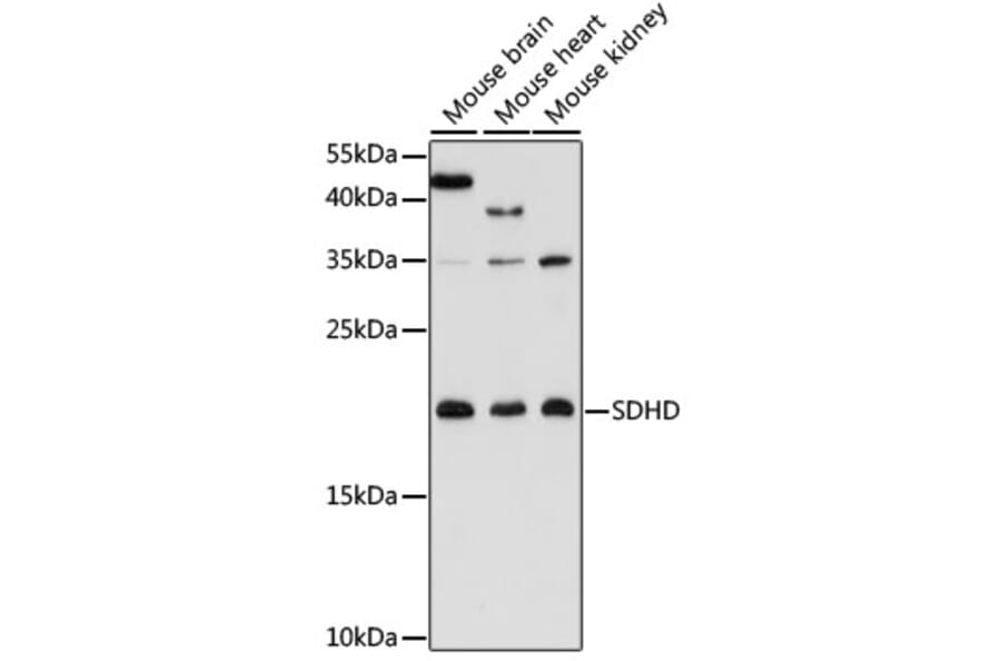 Western Blot - Anti-SDHD Antibody (A91641) - Antibodies.com