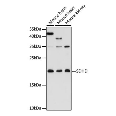 Western Blot - Anti-SDHD Antibody (A91641) - Antibodies.com