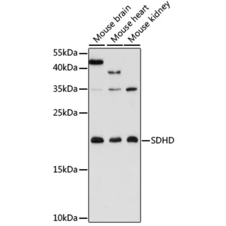 Western Blot - Anti-SDHD Antibody (A91641) - Antibodies.com