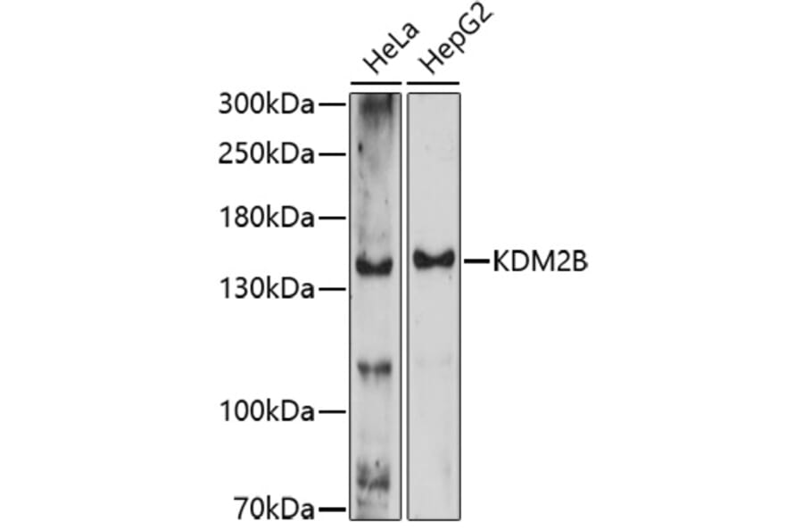 Western Blot - Anti-KDM2B Antibody (A91642) - Antibodies.com