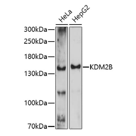 Western Blot - Anti-KDM2B Antibody (A91642) - Antibodies.com