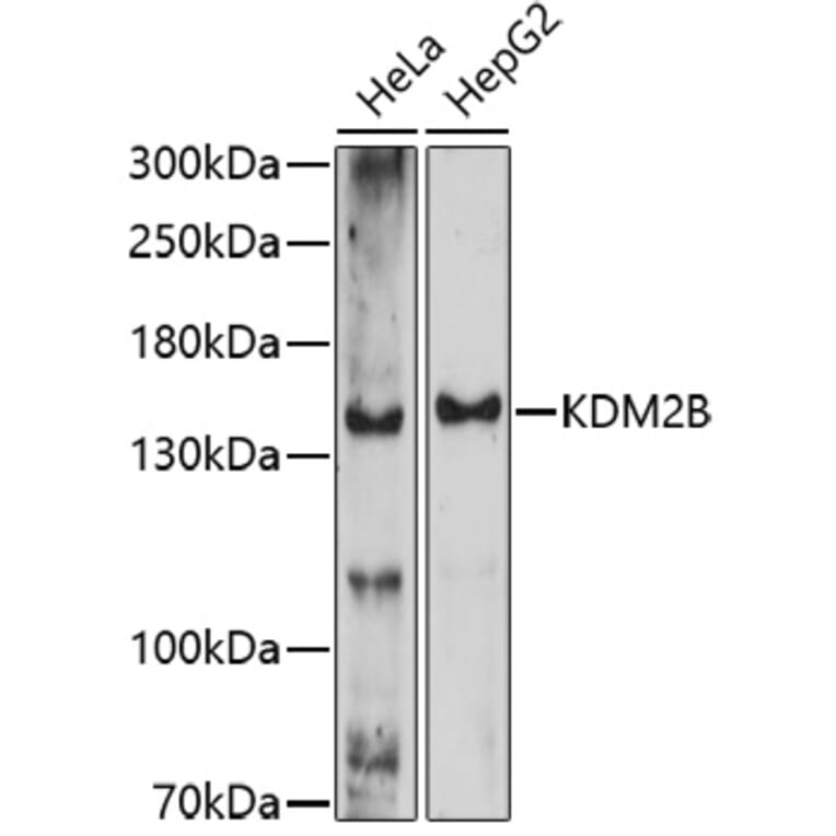 Western Blot - Anti-KDM2B Antibody (A91642) - Antibodies.com