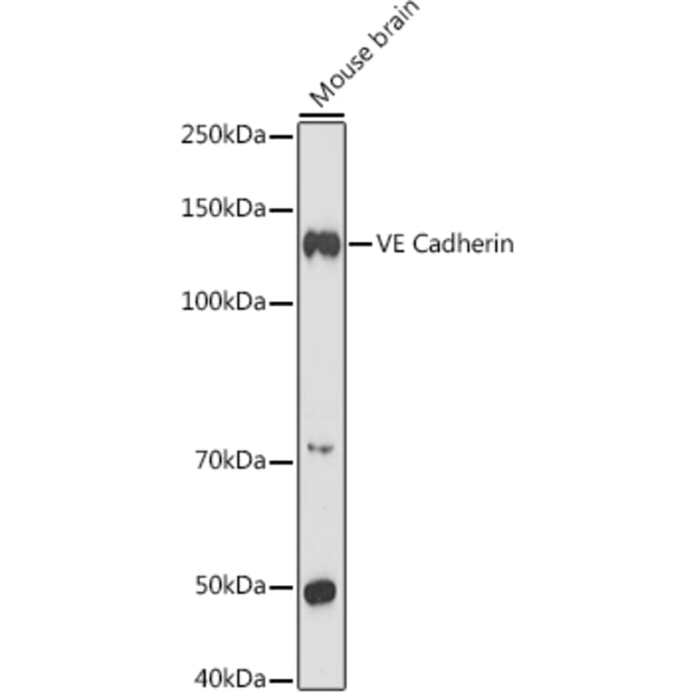 Western Blot - Anti-VE Cadherin Antibody (A91643) - Antibodies.com