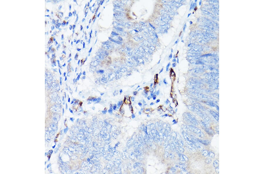 Immunohistochemistry - Anti-VE Cadherin Antibody (A91643) - Antibodies.com