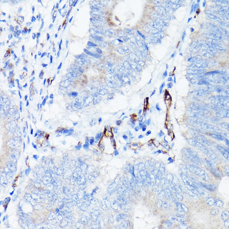 Immunohistochemistry - Anti-VE Cadherin Antibody (A91643) - Antibodies.com