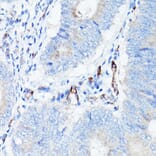 Immunohistochemistry - Anti-VE Cadherin Antibody (A91643) - Antibodies.com