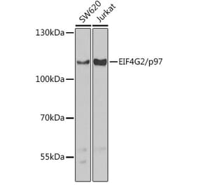 Western Blot - Anti-p97 Antibody (A91646) - Antibodies.com