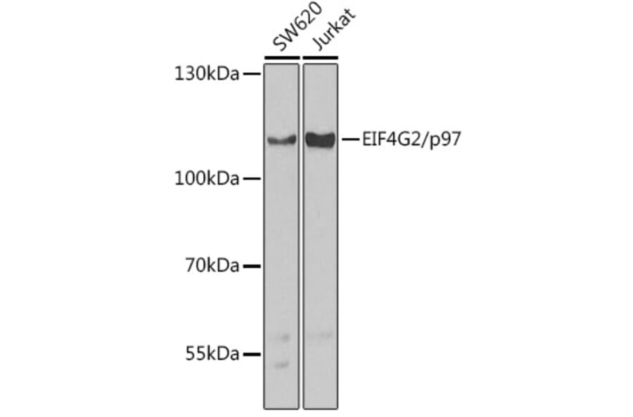 Western Blot - Anti-p97 Antibody (A91646) - Antibodies.com